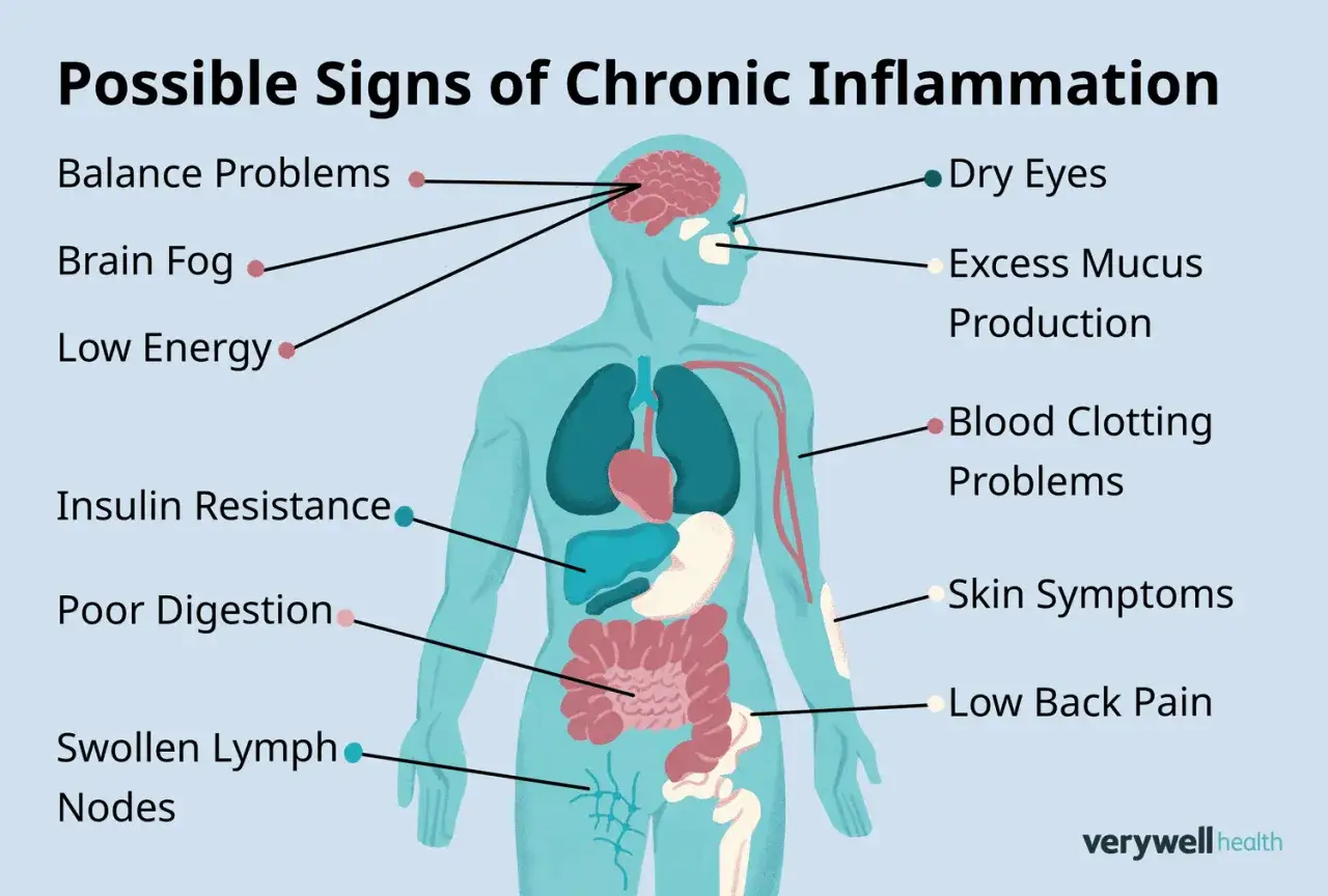 Illustration visar en mänsklig kropp med olika områden markerade som möjliga inflammation symtom, som hjärndimma, torrhet i ögonen och hudproblem.