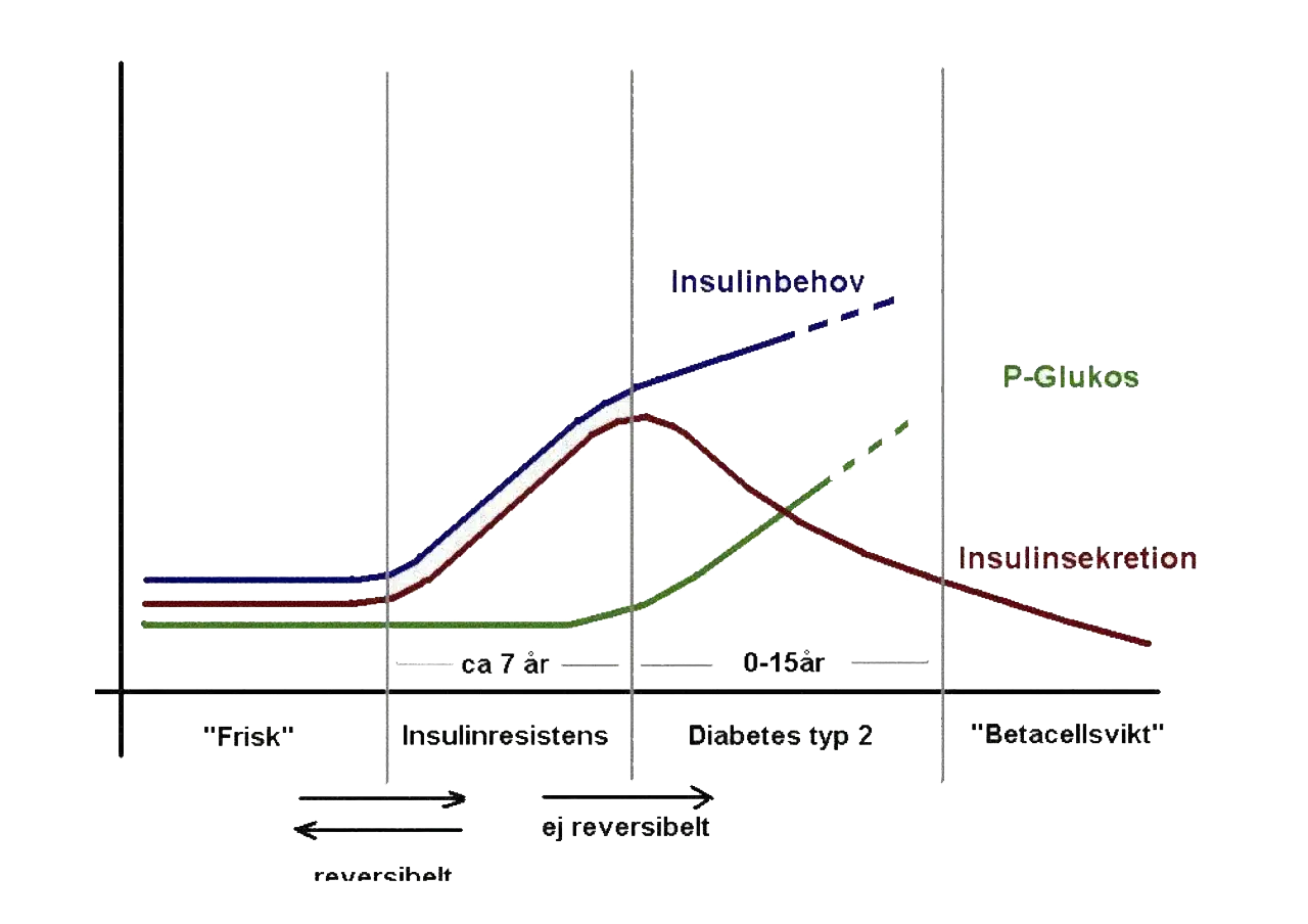 Graf som visar utvecklingen från frisk till pre diabetes, insulinresistens och typ 2-diabetes. Insulinbehovet ökar, medan insulinsekretionen minskar.